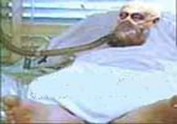 Ariel Şaron 80. yaşına komada girdi