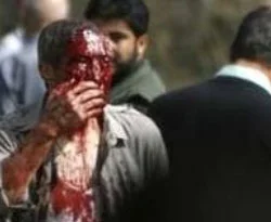 Afganistan'dan ilk görüntüler / FOTO GALERİ