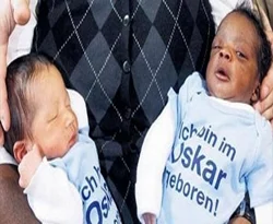 Siyah-beyaz ikizler