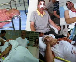 Tersane işçileri ya ölüyor ya dövülüyorlar