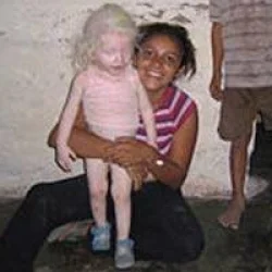 Yine Albino vahşeti