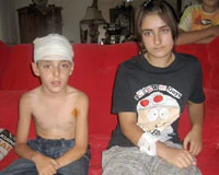 Burdur'daki kuduz vakası