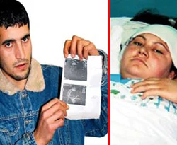 İnanılmaz bir doğum dehşeti