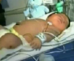 6 kilo 400 gramlık bebek/VİDEO