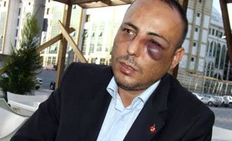 Al sana polis kimliği...!