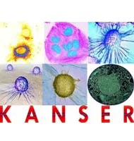 Kanser şarlatanlarına dikkat edin