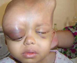 İsrail Gazze?de uranyum kullanıyor / FOTO GALERİ