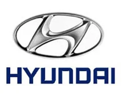 Hyundai 450 işçiyi çıkardığını bildirdi
