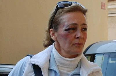 Müdür, bayan öğretmeni darp etti