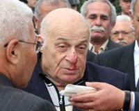 Denktaş'ın ayağı kaydı, yere düştü
