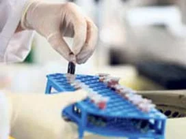 'Hepatit Otobüsü' Türkiye yollarında