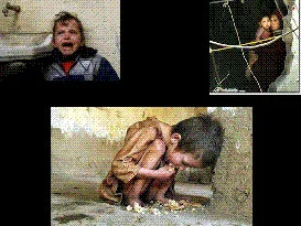 İşte son İsrail vahşetinin bilançosu