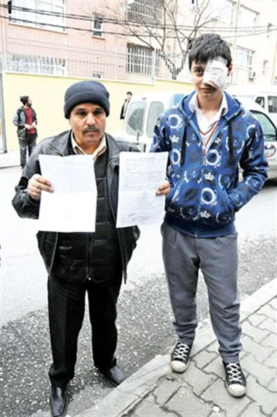 Öğrencinin gözü böyle morartıldı!