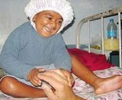 26 yaşında ama bebek görünümünde