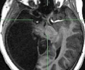 Bilim dünyasını hayrete düşüren olay!