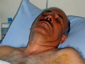 Darp edilen müdür yoğun bakımda