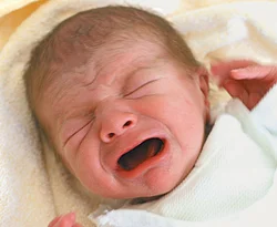 Her yıl 300 bebek anüsü kapalı doğuyor