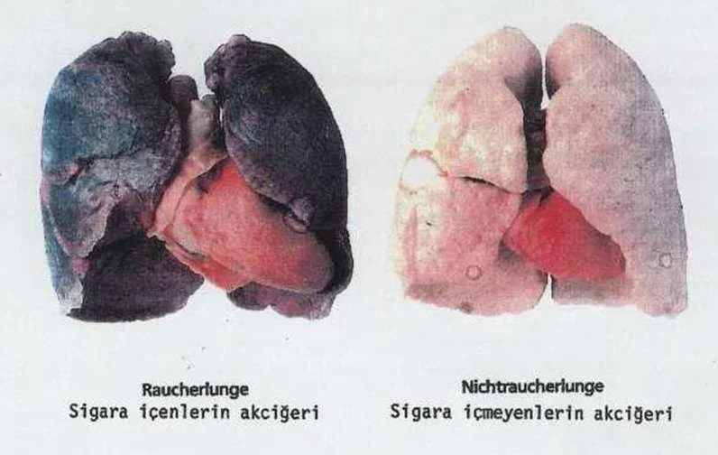 Sigara kalp hastalığı ve felç riskini nasıl artırıyor?