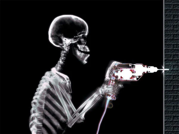 X-RAY ışını ile sanat