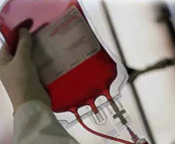 Yeni bir HIV virüs türü belirlendi