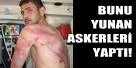 Yunan sahil botları gerginlik yaratıyor