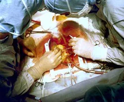 Doktor Hataları Hastalık Kadar Ölümcül