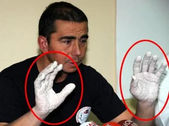 Dünya rekortmeni olmanın bedeli