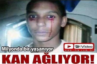 Kan ağlıyor