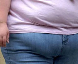 Obezlerde özel bir 'menisküs yırtığı' saptandı