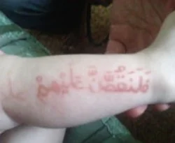 Rusya bu 'mucize bebeği' konuşuyor