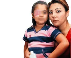 El temizleme jeli gözüne gelen küçük kız, 1 haftadır göremiyor
