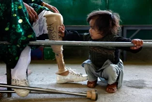 Afganistan'daki acı tablo