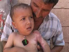 AIDS'li Küçük Yusuf yalnızlığa mahkum