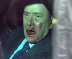 Berlusconi'nin yüzü kan içinde kaldı