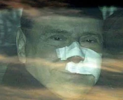 Berlusconi'ye saldırı düzmece mi?