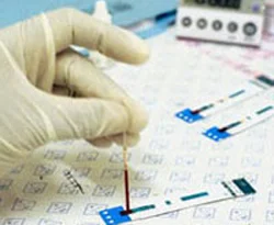 Dünya AIDS gününde önemli uyarı