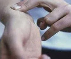 El bileğinden anjiyo kolaylığı