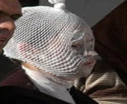 İmam Hatipli öğrencinin yüzüne tuz ruhu