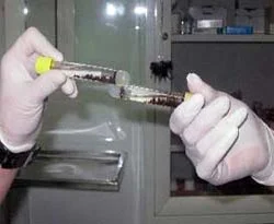 Hepatit B testleri laboratuvarlarda