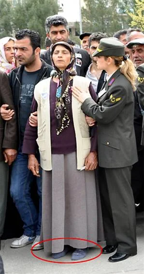 Acının fotoğrafı