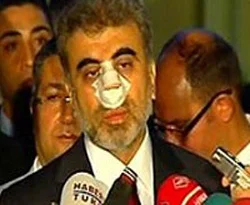 Bakan'a 'geçmiş olsun' mesajı yağıyor