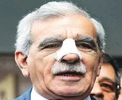 Bir musibet bazen daha hayırlıdır
