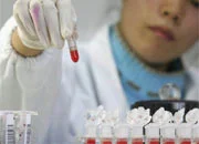 Bu test, kanseri erken tespit ediyor!