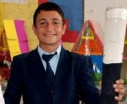 10 TL'ye kendi protezini yaptı