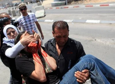 İsrailli askerler Amerikalı aktivistin gözünü çıkardı