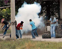 El yapımı bomba gösterici çocuğun elinde patladı