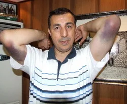 KCK'da tutuklandı, hastalığı başladı