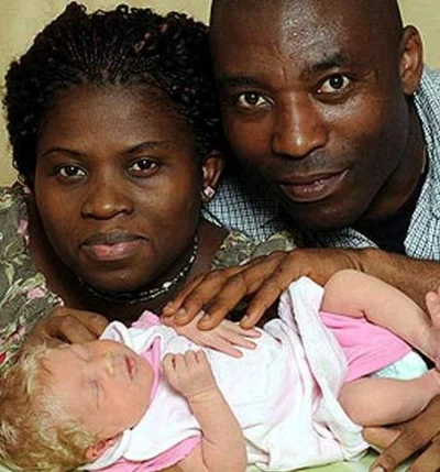 Siyah anne ve babadan sarışın çocuk