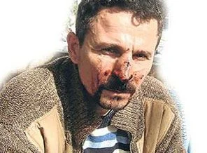 Karakolda dayak yedi, 155'i aradı ama...