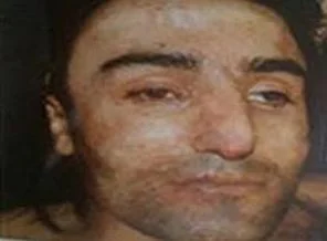 Canlı bomba takipteydi iddiası